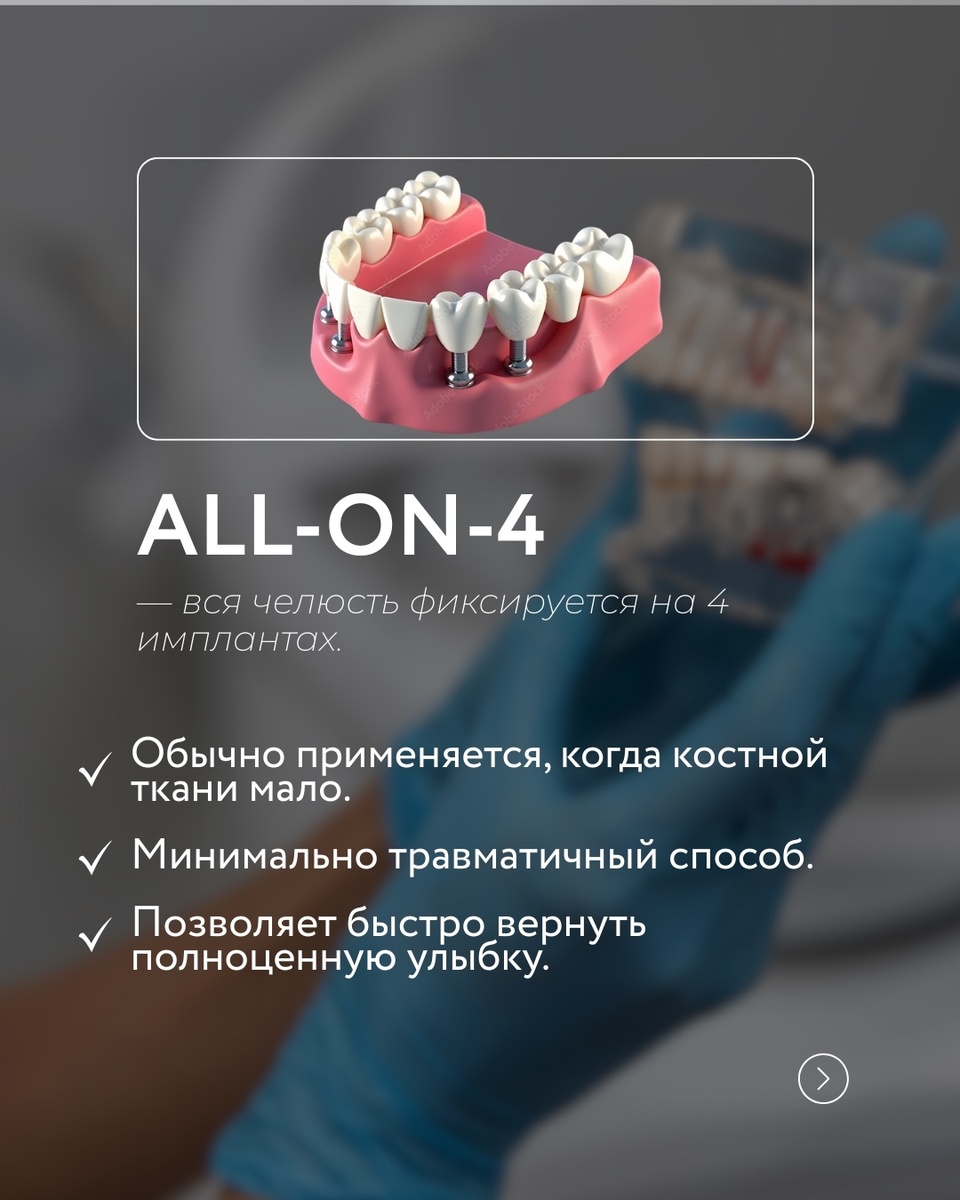 «Все на 4»