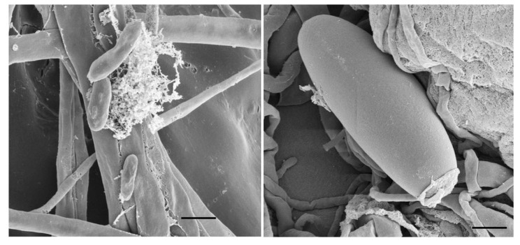 Fig. 2 Scanning electron micrographs of the imperfect stage fungus En-22. The microspores are pictured on the left and a macrospore is shown on the right. The bar (left) is equal to 3 μm and the bar (right) equals 4 μm