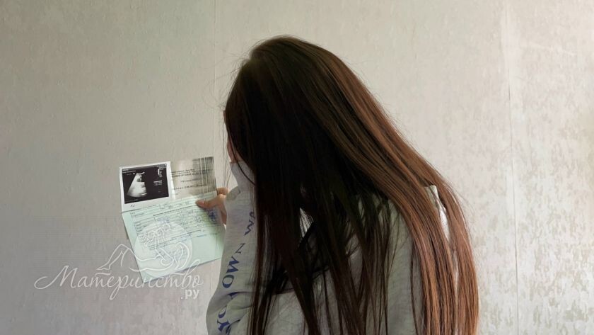 Когда тошнота убивает: почему врачи могут прервать беременность из-за токсикоза