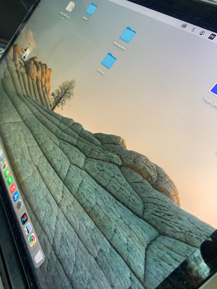 Retina