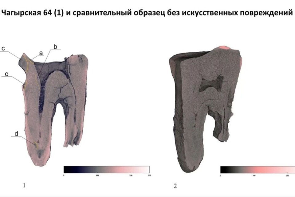    Сравнительный анализ зуба. Фото: Алиса Зубова Лидия Зоткина, Ксения Колобова