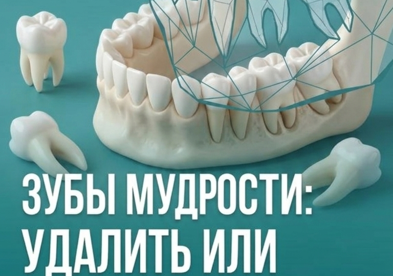 Нужно ли удалять зуб мудрости ?