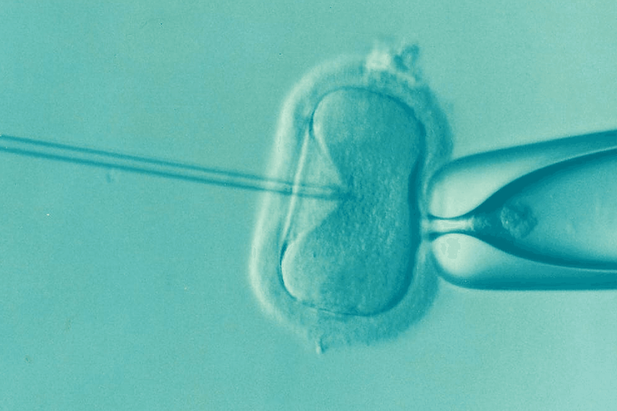    Фото: DrKontogianniIVF, pixabay.com