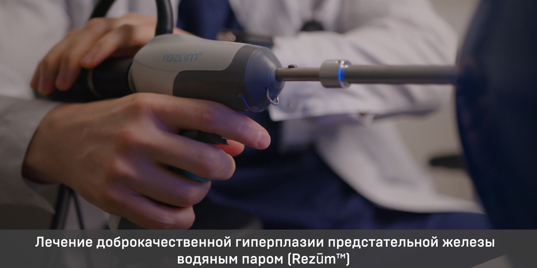 Лечение аденомы простаты