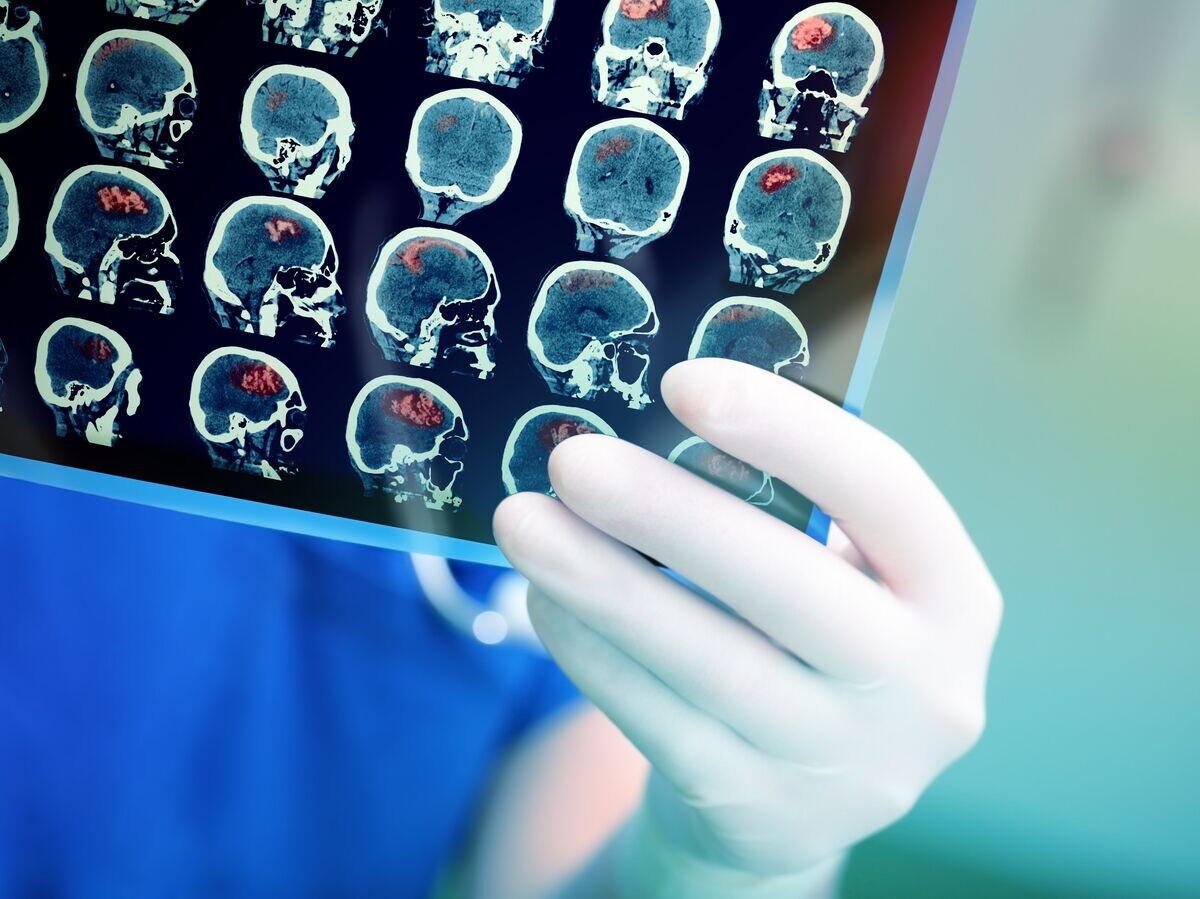    Врач смотрит результаты КТ головного мозга пациента | © Depositphotos.com / sudok1