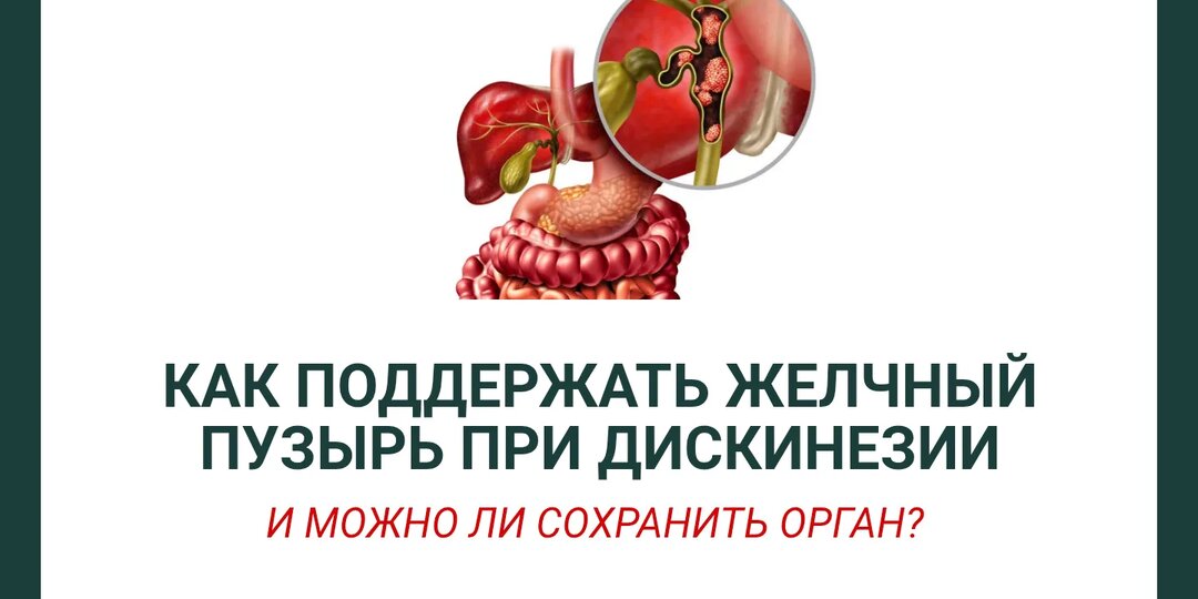 Как поддержать желчный пузырь при дискинезии (и можно ли сохранить орган)