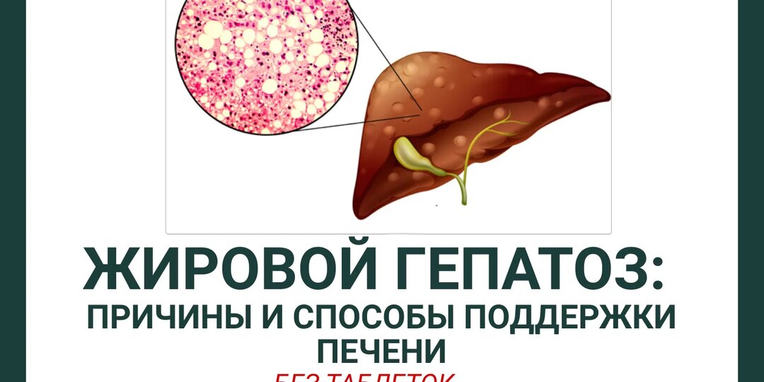 Жировой гепатоз: причины и способы поддержки печени (без таблеток)