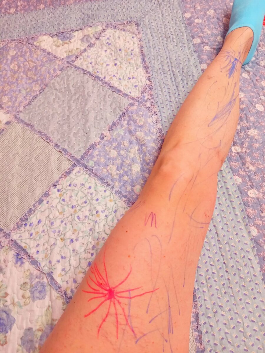 Внучка считает, что моя нога должна выглядеть так💖 