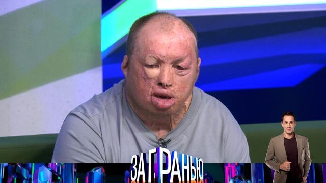 Такие сюжеты долны вызывать интерес у пластических хирургов, но никак у обычных людей .