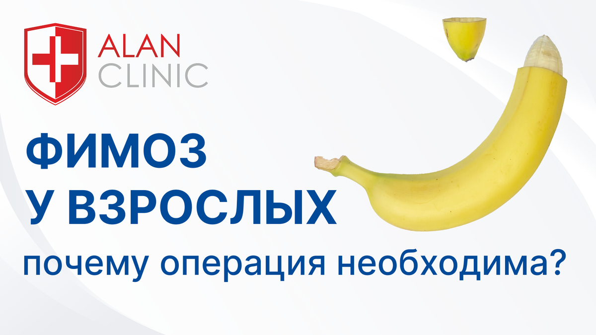 Фимоз у взрослых: почему операция необходима