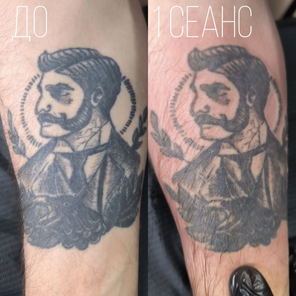 -2