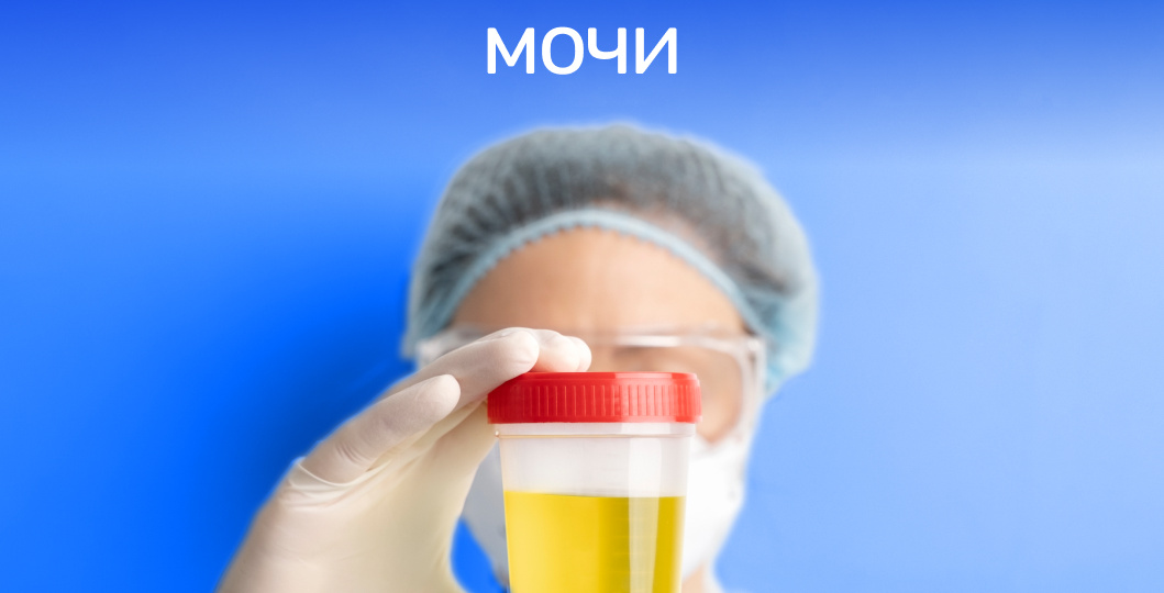 Проверка на прочность: как правильно сдать анализ мочи