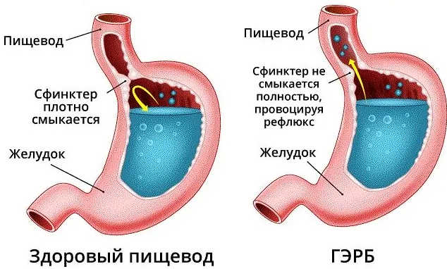 Источник: gkb-buyanova.ru