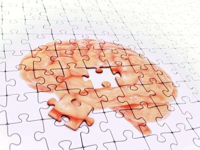 https://scx1.b-cdn.net/csz/news/800a/2021/autopsy-study-shows-ho.jpg  https://medicalxpress.com/news/2021-06-autopsy-covid-brain.html