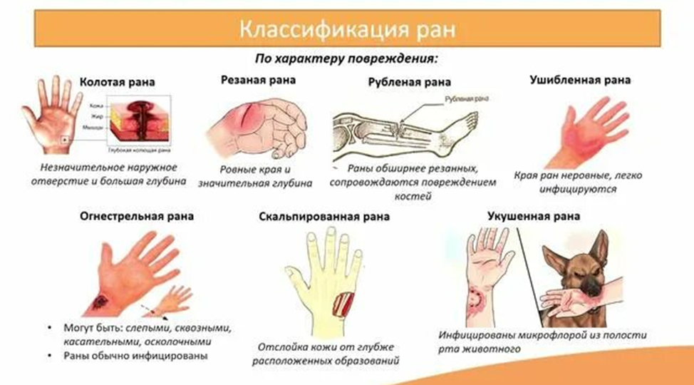 Раны и раневая инфекция. Основное!