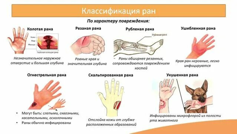 Классификация ран