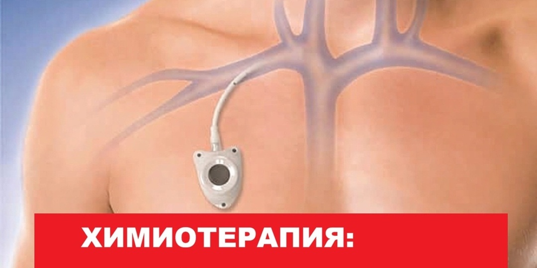 ХИМИОТЕРАПИЯ: онколог с 20-летним стажем рассказал, что нужно знать каждому пациенту