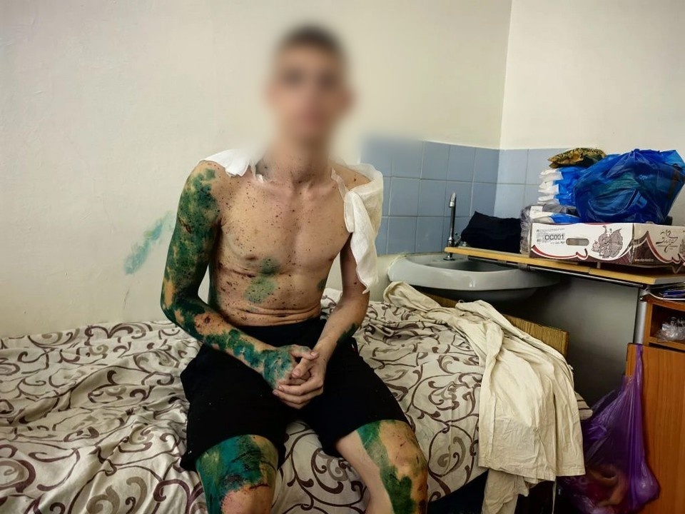    Студент при ударе ВСУ по Старобельску упал с пятого этажа и чудом выжил Юлия АНДРИЕНКО
