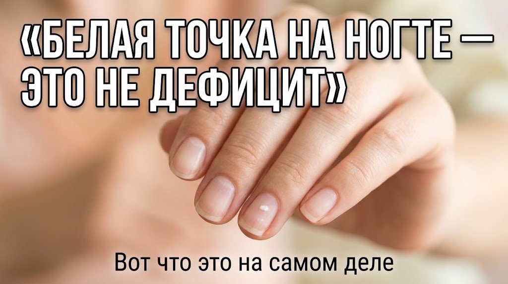 ноготь был ровный, а сегодня по нему идёт аккуратная светлая чёрточка.