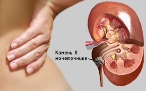 Что надо? Изюм темный без косточек. перец черный горошком (душистый не годится).