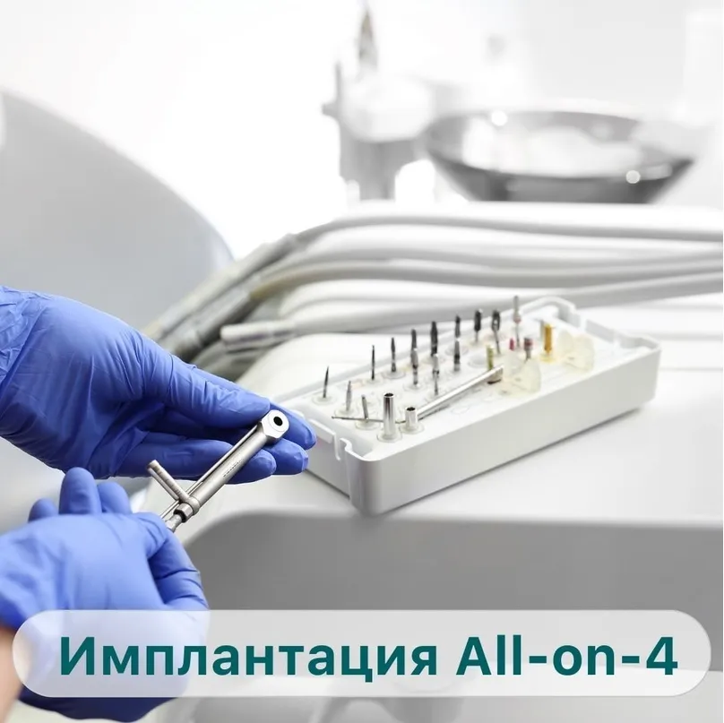 Протезирование зубов по технологии "all-on-4"