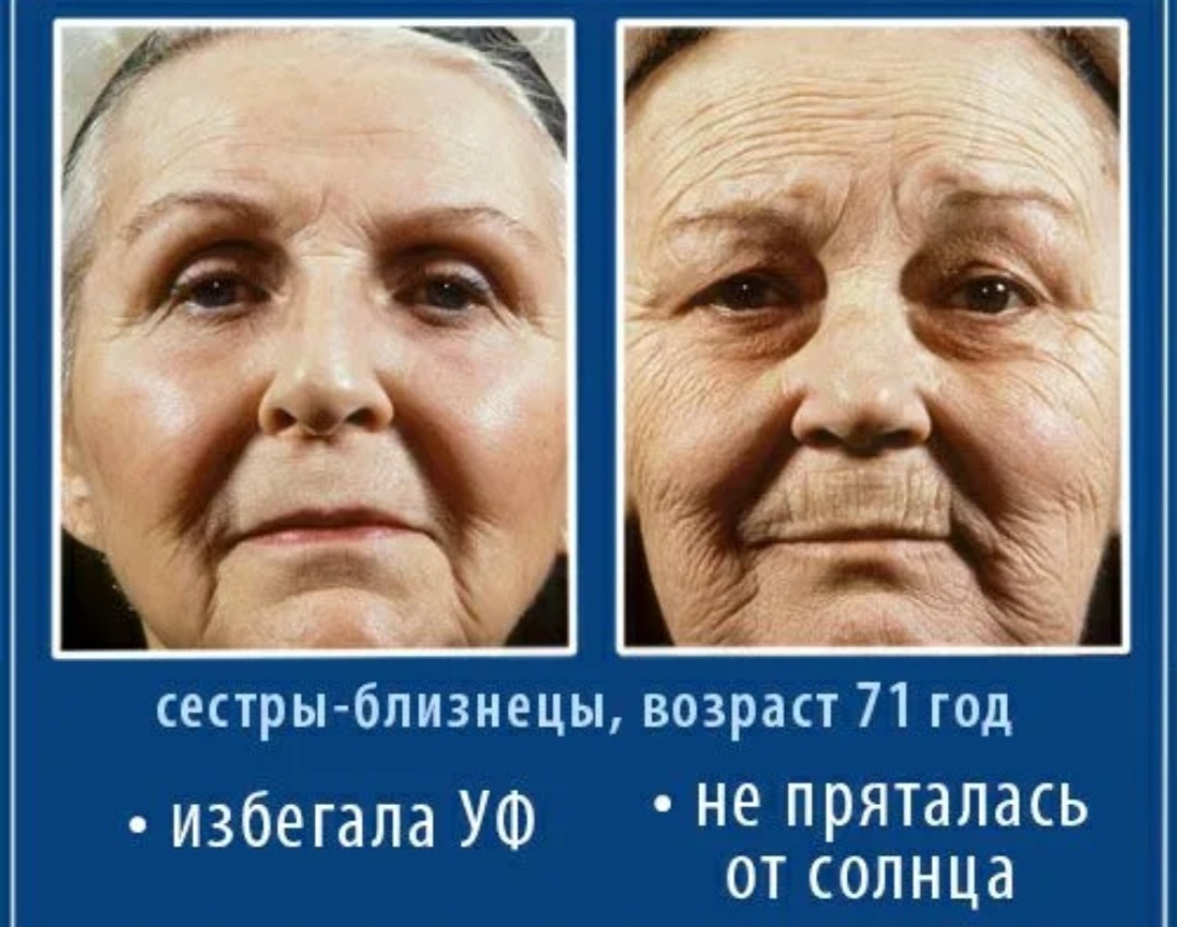 Можно найти множество фотопримеров, как по-разному выглядит кожа тех, кто пользовался солнцезащитой против тех, кто не пользовался