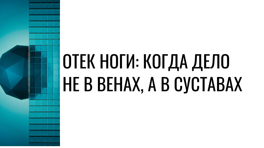 Отек ноги: когда дело не в венах, а в суставах