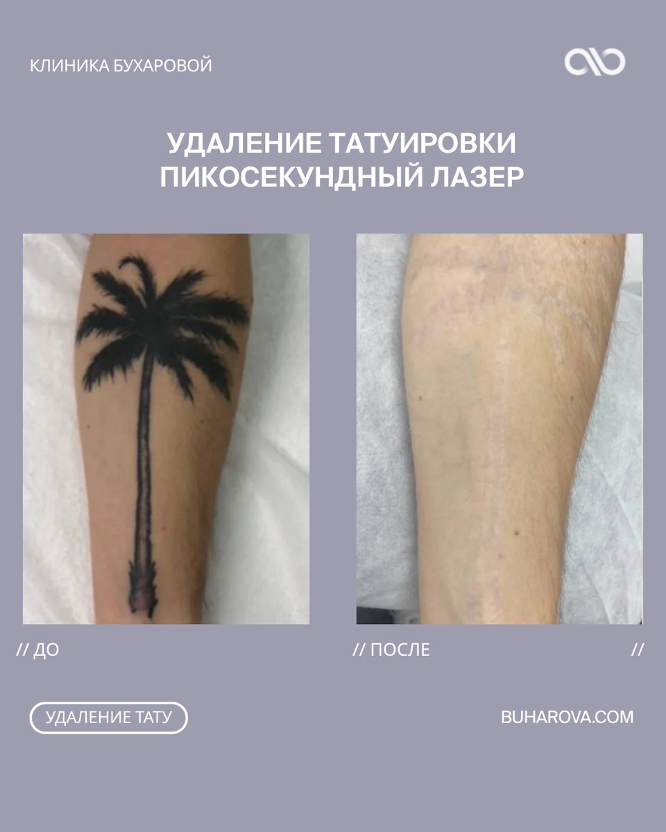Вот таких впечатляющих результатов можно добиться за несколько сеансов