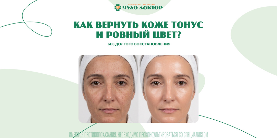 Фотодинамическая терапия Heleo4 для лица