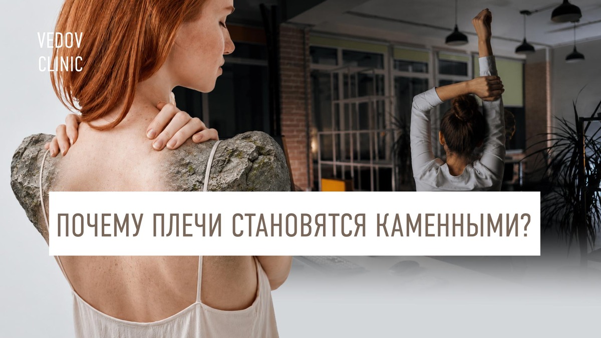 Почему плечи становятся каменными? Виноват не только стресс.