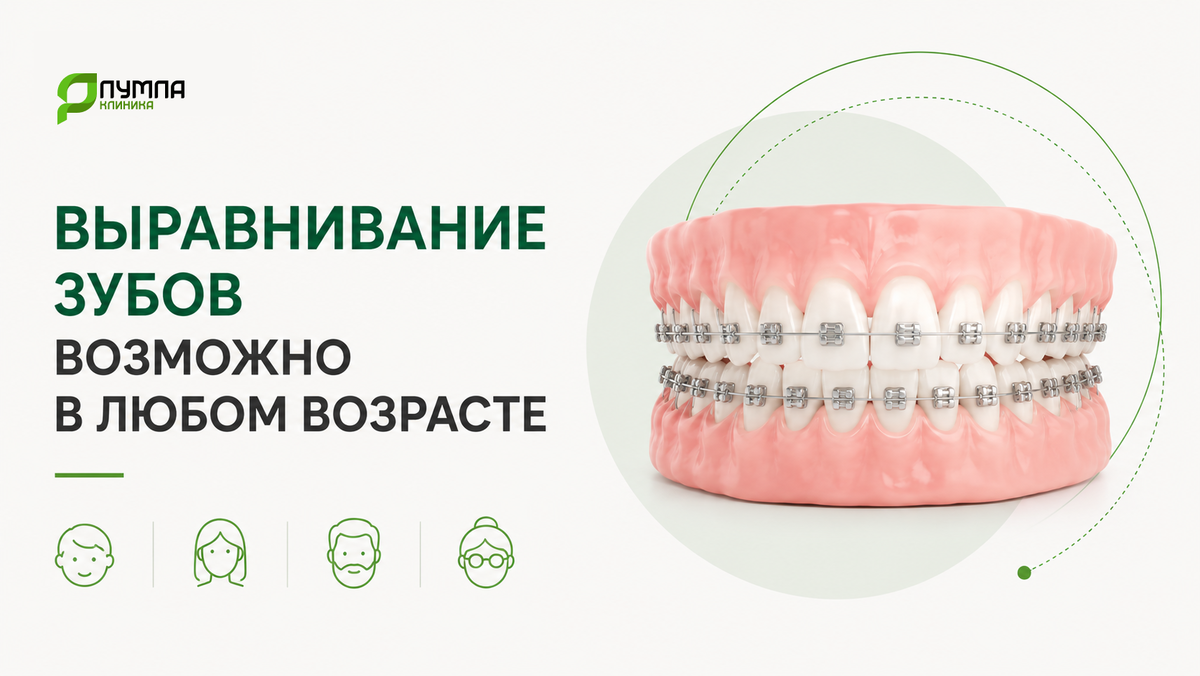 Можно ли выровнять зубы после 30–40 лет