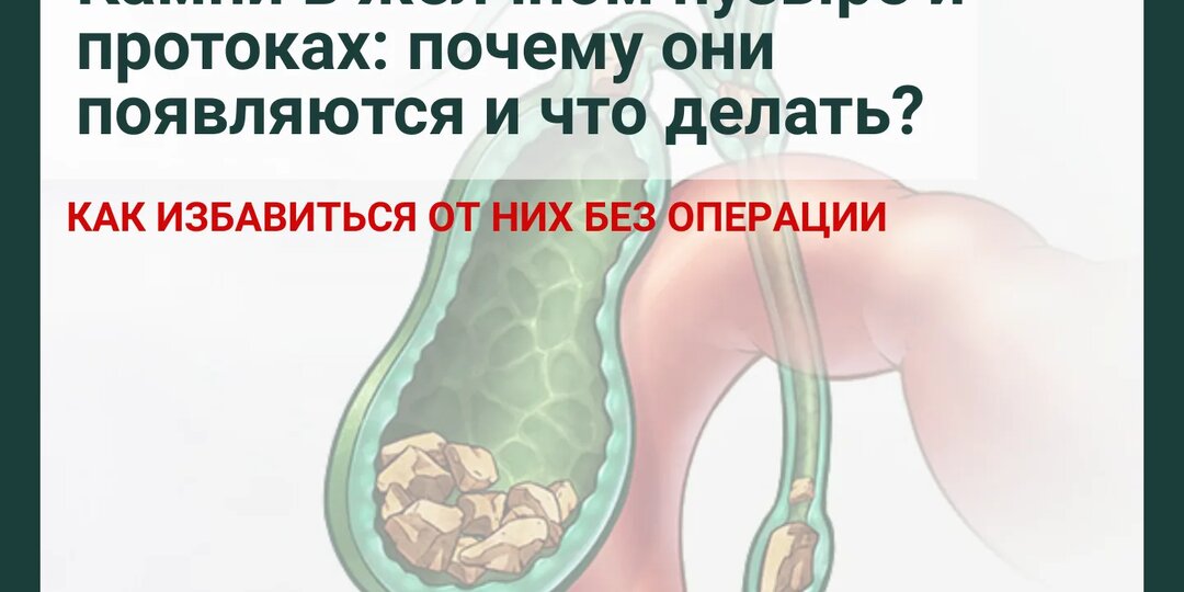 Камни в желчном пузыре и протоках: почему они появляются и что делать? И как избавиться от них без операции