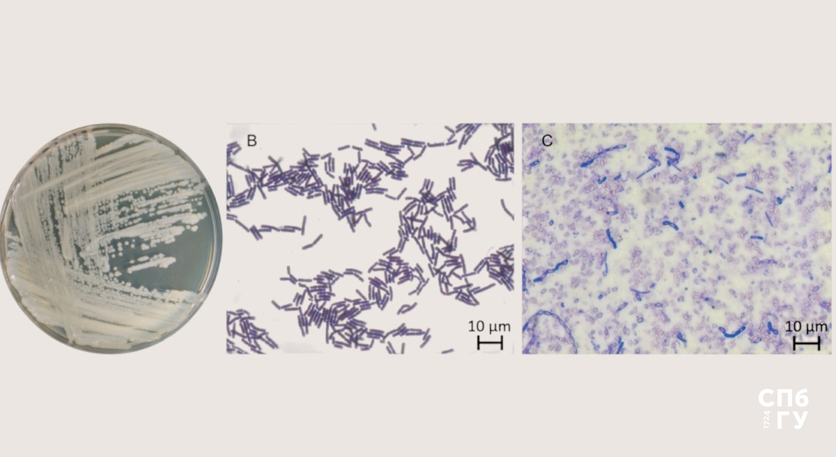 Бактерия, открытая на Алтае. Взято из International Journal of Molecular Sciences