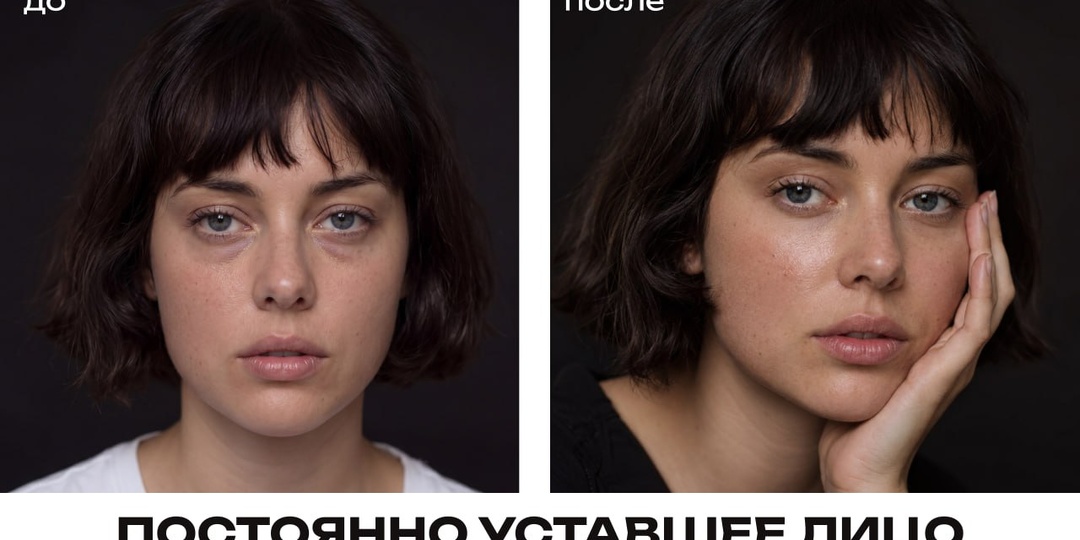 Что делать с постоянно уставшим опустившимся лицом?
