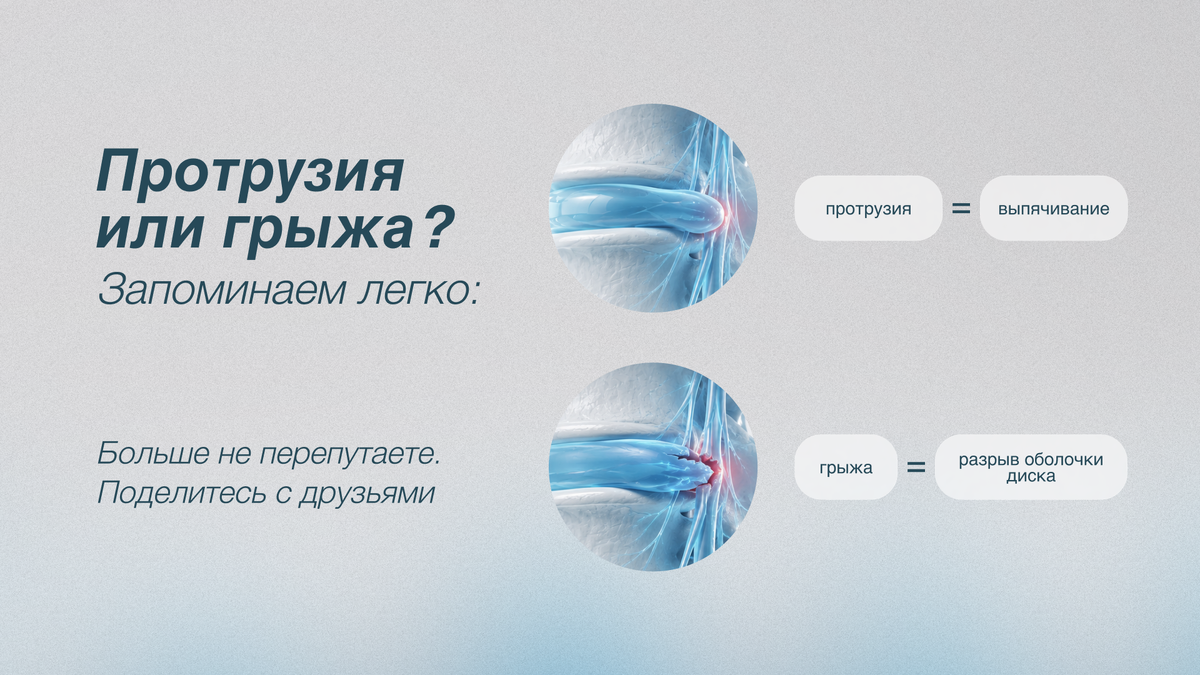 Протрузия или грыжа?