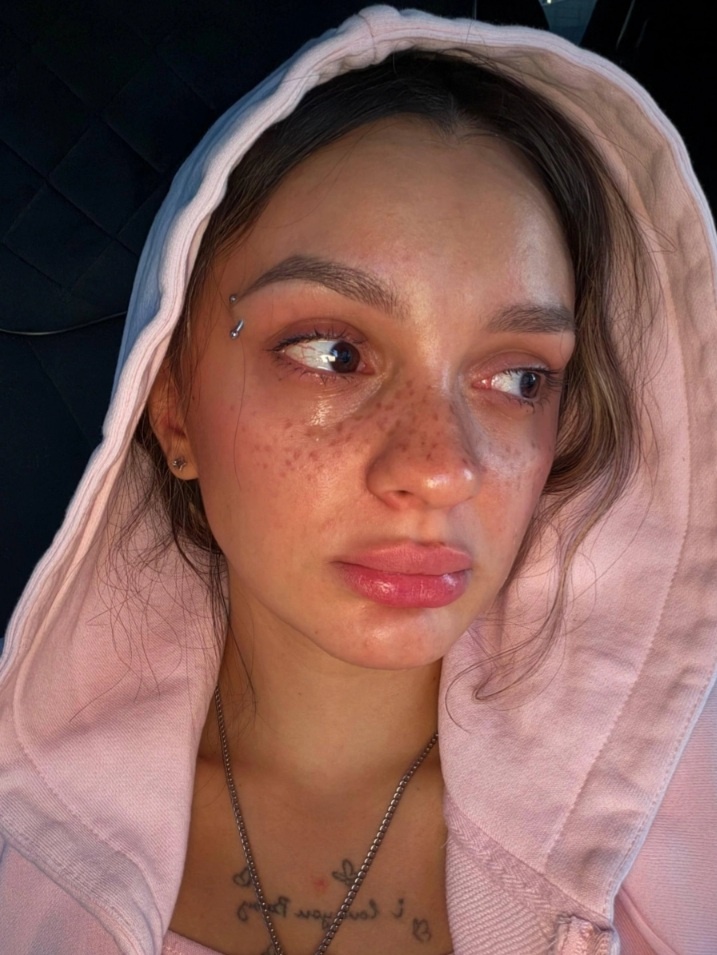 -2
