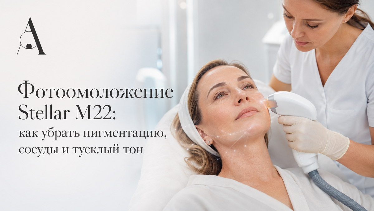 Фотоомоложение Stellar M22: как убрать пигментацию, сосуды и тусклый тон