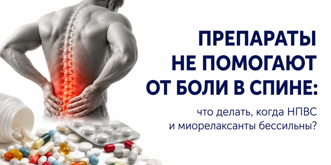 Препараты не помогают от боли в спине: что делать, когда НПВС и миорелаксанты бессильны?