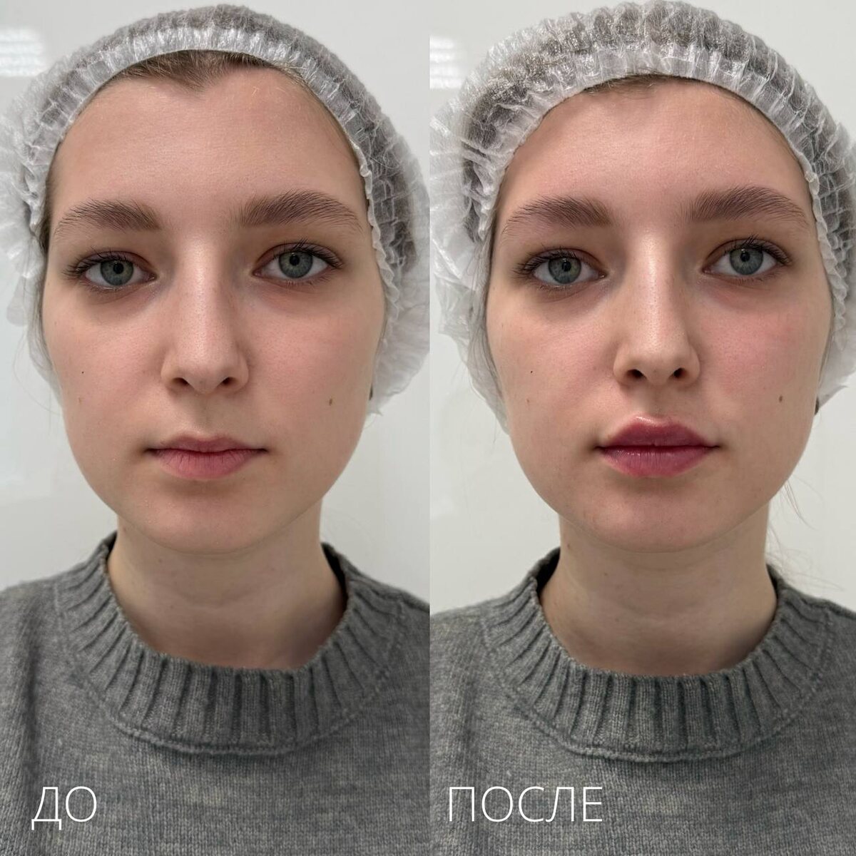 ДО и ПОСЛЕ