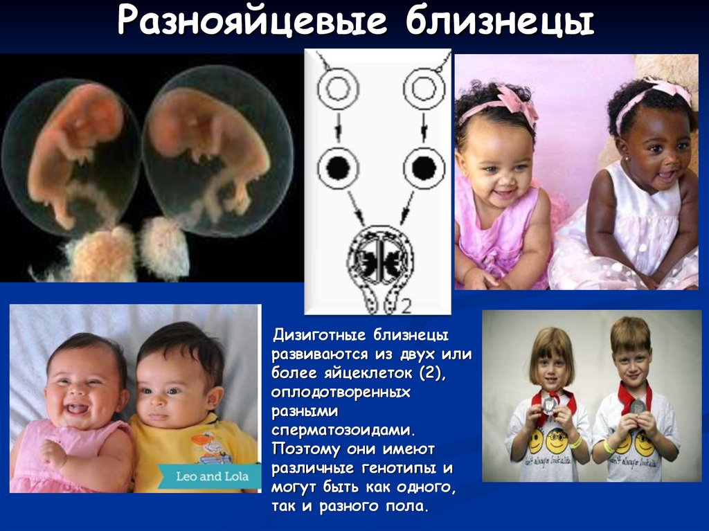 Слияние двух эмбрионов на раннем сроке — главная причина природного химеризма
