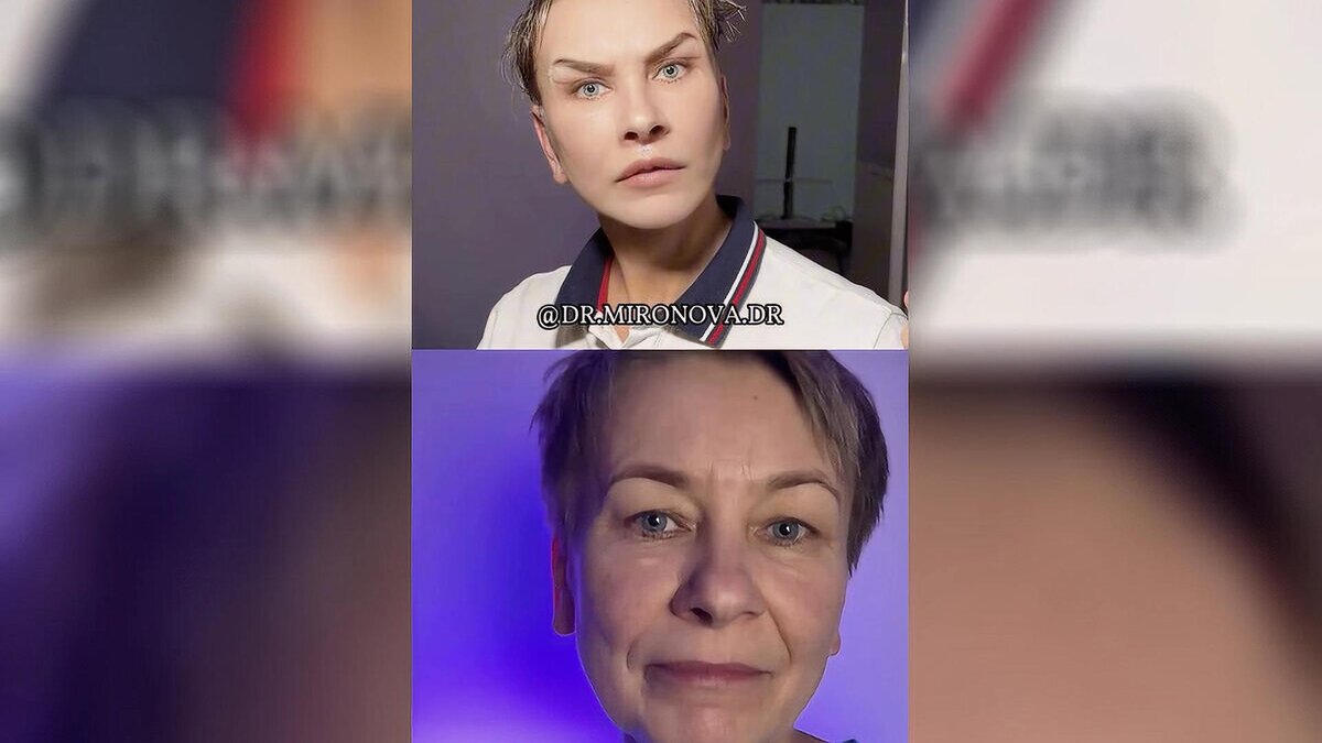 -2