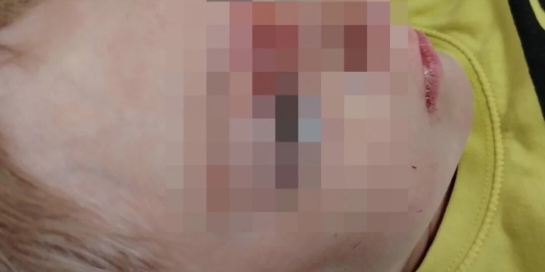 В Перми мама ищет свидетелей, видевших как в её ребёнка бросили камнем