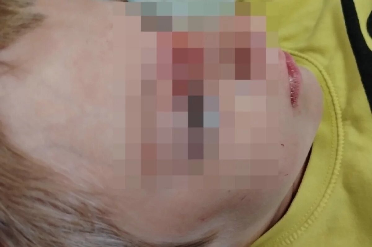    В Перми мама ищет свидетелей, видевших как в её ребёнка бросили камнем