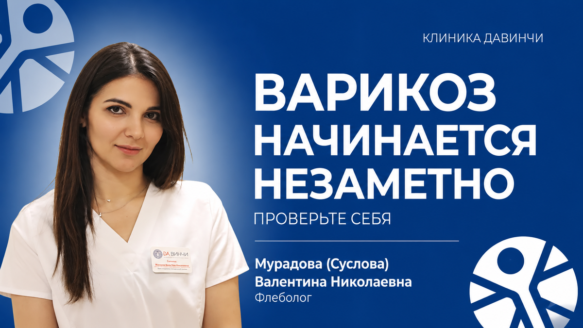 Варикоз часто начинается с тяжести в ногах, отёков и сосудистых «звёздочек», которые многие долго считают обычной усталостью.