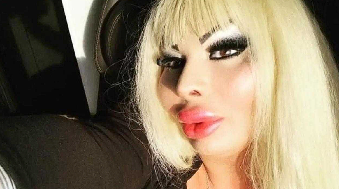 -2