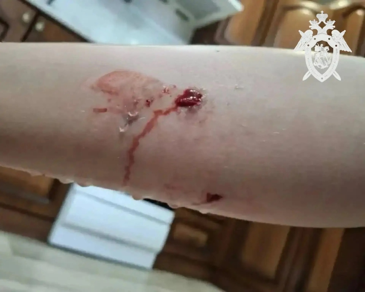 -2