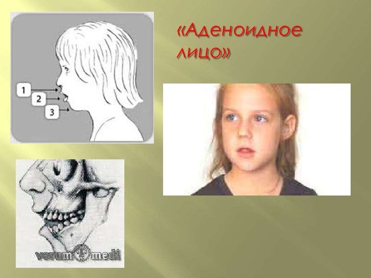 Картинка взята из Яндекс 
