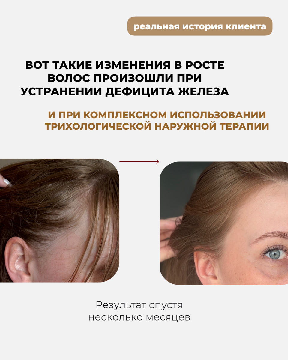 Результаты до/после
