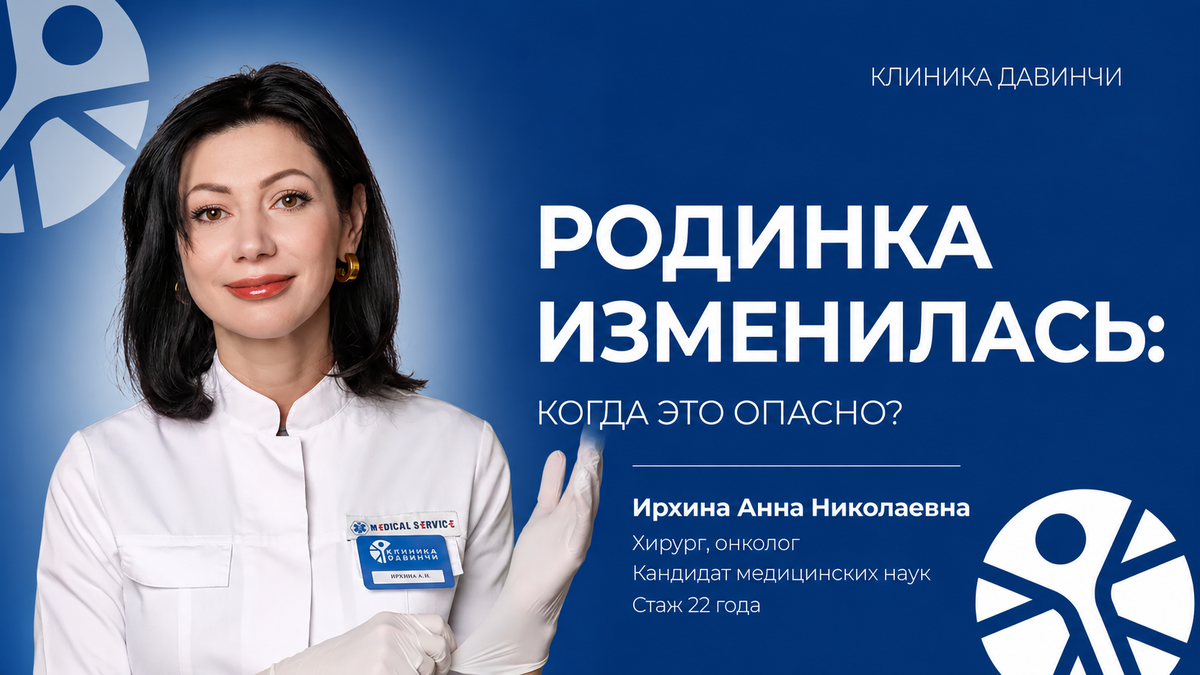 Изменение формы, цвета или размера родинки — повод пройти дерматоскопию и показать образование врачу.