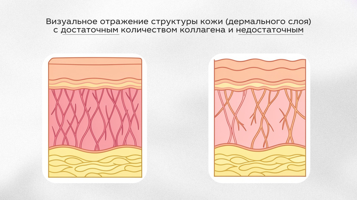 Визуализация структуры кожи и кол-ва коллагена в норме и дефиците | сеть клиник косметологии GEN87 Москва